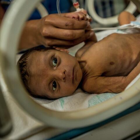 Venezuela, donde los niños mueren de hambre Venezuela, donde los niños mueren de hambre