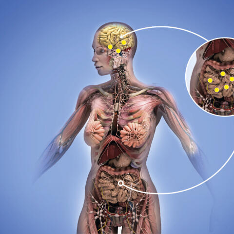 El párkinson empieza en el intestino El párkinson empieza en el intestino