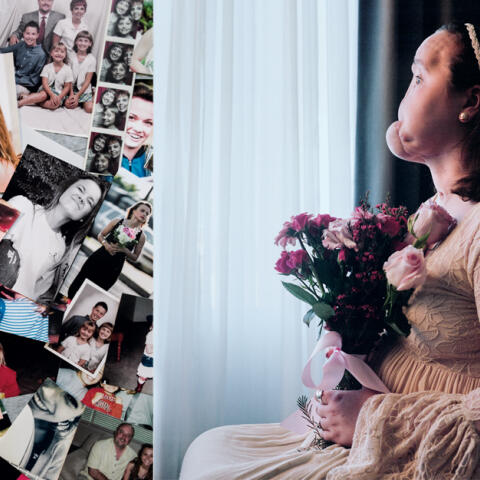 Trasplante de cara, una segunda oportunidad para Kate Trasplante de cara, una segunda oportunidad para Kate